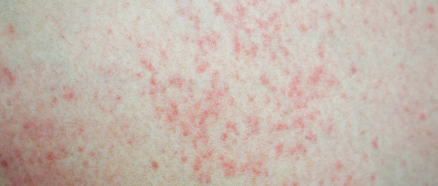 情緒護(hù)膚,心理學(xué),情緒評(píng)估,科學(xué)工具