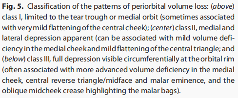 7a5c2929e7dd7f8f7db6d7fbd55a34de