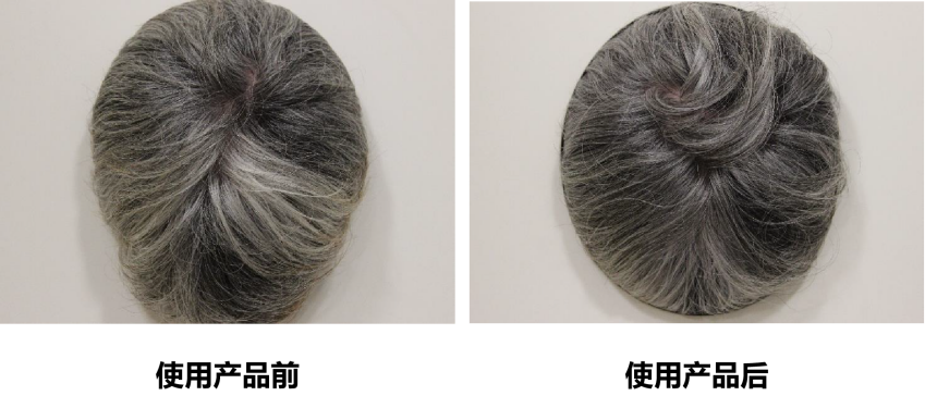 頭皮健康,紅斑,,丘疹,膿皰,評價(jià)方法