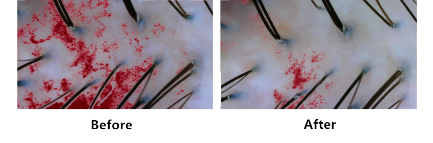 Scalp,health,Cosmetc,Efficacy,Evaluation